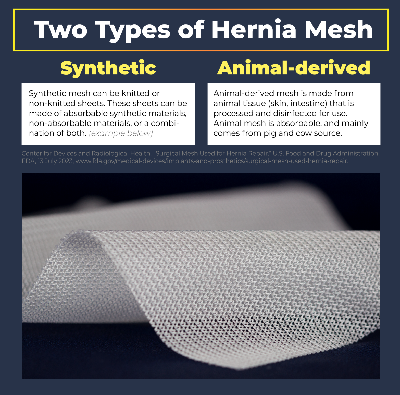 Hernia Mesh Lawsuit August 2024 Updates And Settlements 1731