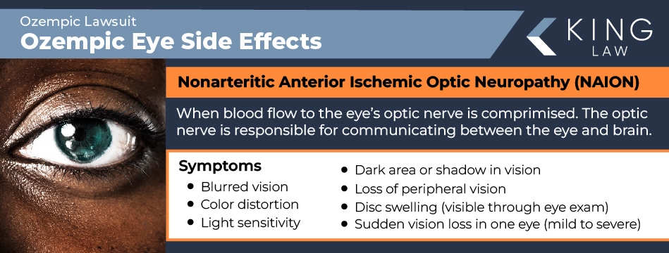 Infographic naming what NAION is and what are the symptoms of NAION. Image close up of a black person's eye. 