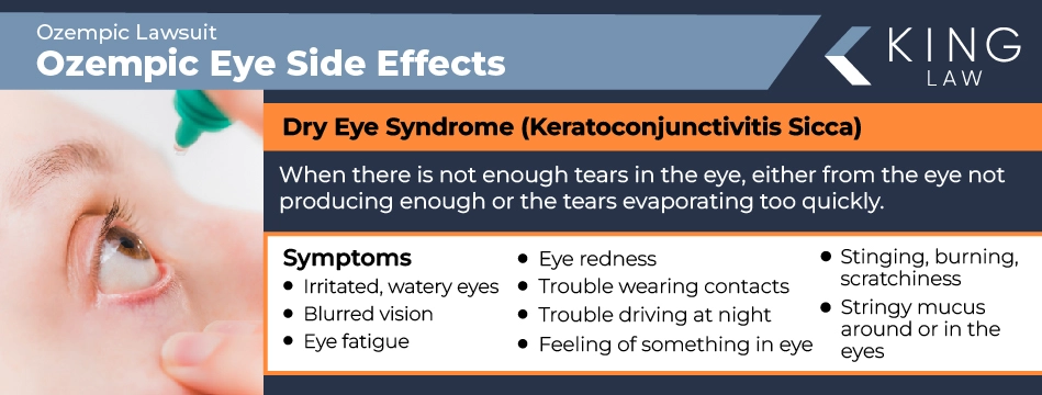 Infographic describing dry eye syndrome and it's side effects. Image of a young white person putting eyedrops in an eyeball. 